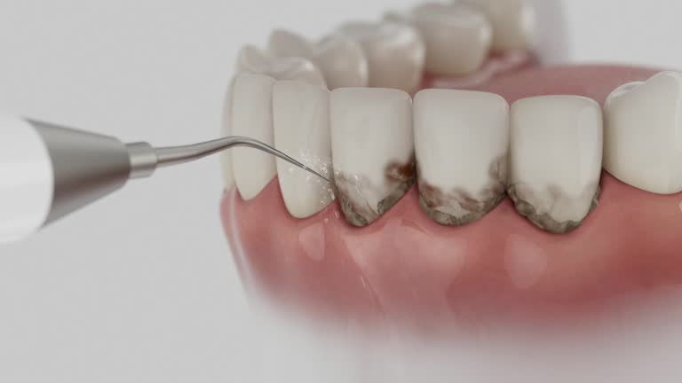 Trusted Teeth Cleaning And Checkup service in New Baltimore, MI - Dentist Open Now